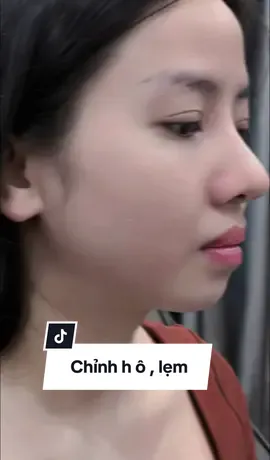 ✨𝐂𝐚̆̀ 𝐦 𝐕𝐥𝐢𝐧𝐞  ➡️𝐂𝐡𝐢̉𝐧𝐡 𝐇 𝐨̂  ✨𝐗𝐎𝐍𝐆 Đ 𝐄̣𝐏 Đ𝐈 𝐂𝐇𝐎̛𝐈 𝐍𝐆𝐀𝐘. #kimnganbeauty #tiemfillerbinhchanh #viral #tiemfillerdep #camvline                        