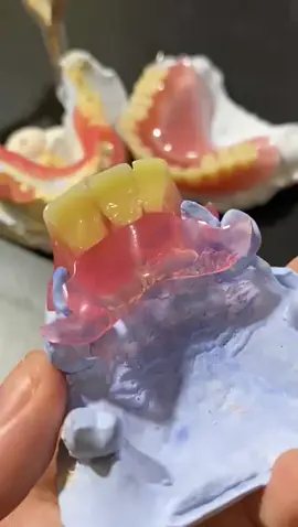 #fyppppppppppppppppppppppp #fypage #gigipalsuberkualitas #dental #trendingvideo 