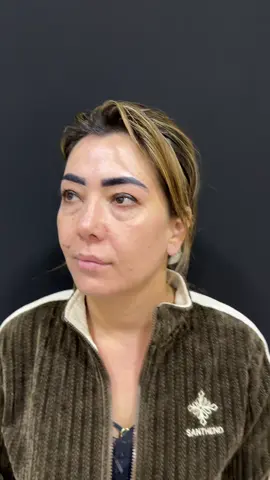 Ушбу опамизни биргина қовогини олиш ва юз тортиш орқали 20 ёшга ёшартириб юбордик😇 (Алоқа учун: 90-496-10-06)