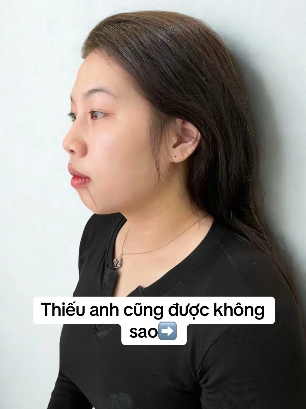 Đúng hog mí bà #filler #nydebeauty #viraltiktok #tiktokxuhuong #tiemcam 