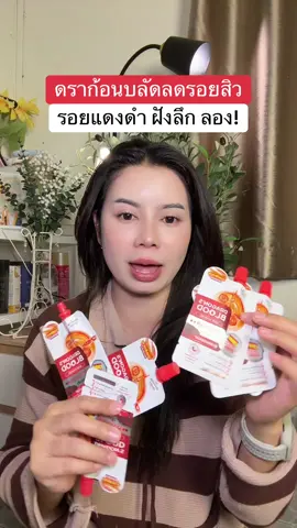 #ลดรอยสิว #ดราก้อนบลัด 