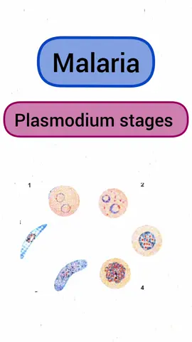 Plasmodium stages - Malaria