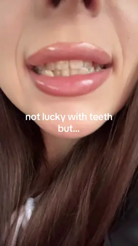 i want braces so badly #braces #viralvideos 
