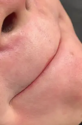 Độ môi ăn tết đi mấy bà, tháng này bên mình có khuyến mãi hấp dẫn lên đến 20% luôn á❤️#phunmoiximui #phunmoibongmongmin #phunmoitrongtreo #phunmoideptunhien ##khuthammoi 