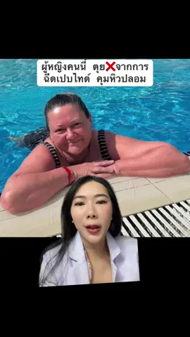 ผู้หญิงคนนี้ ตุย❌จากการ ฉีดเปบไทด์ คุมหิวปลอม #หุ่นดี #กระชับสัดส่วน #โดยแพทย์ #เทรนด์วันนี้  #เตือนภัย  @หมอเต้หมอเธีย เคลียร์เรื่องผิว  @หมอเต้หมอเธีย เคลียร์เรื่องผิว  @หมอเต้หมอเธีย เคลียร์เรื่องผิว 