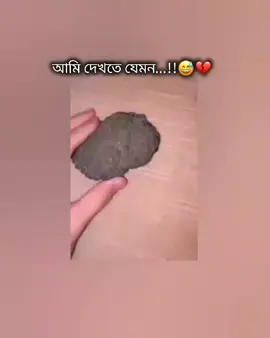 দেখতে অসুন্দর হতে পারে কিন্তু মনের দিক থেকে নয়...!!🥹🫶🏻❤️‍🩹 #tik_tok #foryou #pppppppppppppppp #fffffffffffyyyyyyyyyyypppppppppppp #_sami_804 