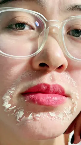 Tinh chất hút sắc tố nám#tannhang #xuhuong #taitaoda #nam #pellda 