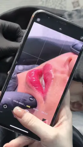 Môi sau bong #phunmôitựnhiênbìnhthạnh #phunmôiđẹpbìnhthạnh 