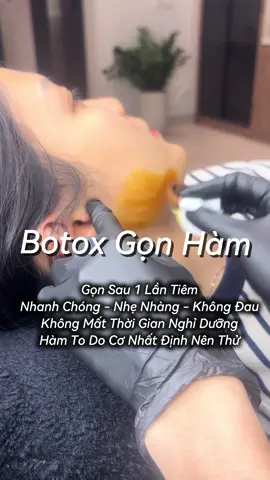 Thời điểm vàng tiêm botox gọn hàm để kịp Tết có mặt gọn xinh 😍 #khanhhabeauty  #fillerbotox  #botoxgonham  #