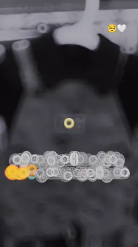 #في هذا اليوم #شو_معكم_بنوتي_ول_صبي💙 #حوامل_اي_شهر_صرتو_🤰🤰😍🦋 