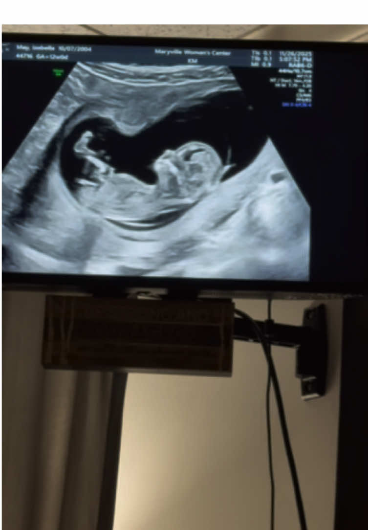 Infinity🤍. #12weekspregnant #12weekultrasound #fyp #ultrasound #2026baby 