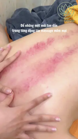 “Khi cơ thể mệt mỏi, tâm trí cũng khó được an yên. Hãy cho bản thân một khoảng lặng, nhắm mắt và để từng động tác massage lan tỏa sự thư thái từ đầu đến chân. Mỗi phút trôi qua là một chút căng thẳng được gỡ bỏ, một chút năng lượng được nạp lại. Bạn xứng đáng với sự chăm sóc dịu dàng này #massagebody #thiennhienspa #spacantho #goidauduongsinh #xuhuong 