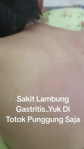#topungsehatalami #topungberkahsehatkarawang #topungsakitlambung #topunggastritis