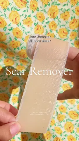 Saan aabot ang 75 pesos mo?? Buy this scar remover for only 75 pesos  #scars #scarremover #scarsheets #scar #fyp 