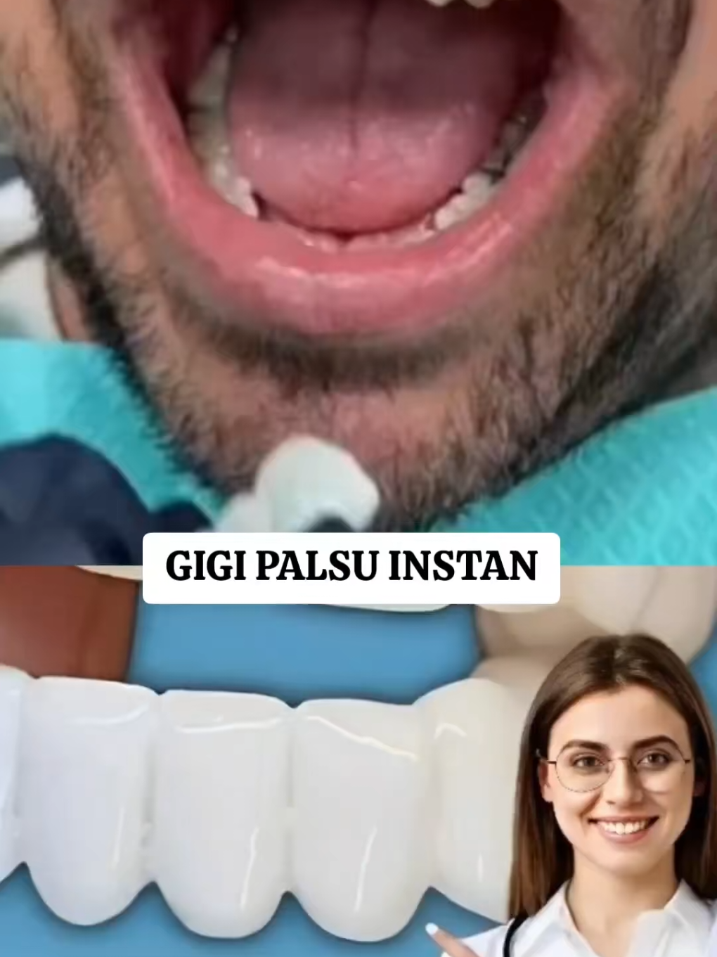 GIGI PALSU INSTAN SIAP PAKAI  #gigipalsumurah #gigipalsulepasan #gigipalsu #fyp 