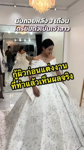 กู้ผิวก่อนแต่งงาน💗 #พลอยแง้ดๆ #chamecollagenplus #chame #ชาเม่คอลลาเจน 