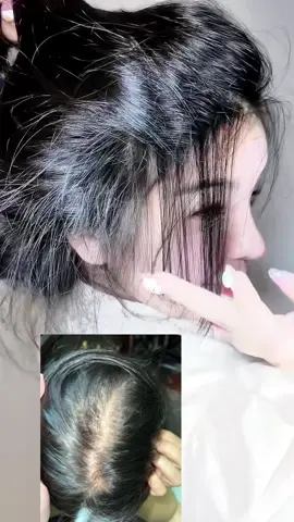 Khắc tinh của những cụ tụng tóc hói đầu vô xịt liền#xitmoctoc #mọctoc #fyp #viral #foryou 