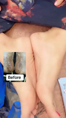 Shakiira😩👌#zowdacosmetics #zowdahcollection👗 #zowdah #onedaycream💯 #subeer__gacal🦁😍 @iskaashi general training 