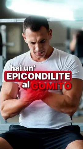 📌 EPICONDILITE: esercizio sì… ma non sempre basta Quando il dolore al gomito non passa, spesso il problema non è solo l’infiammazione, ma come sta il tendine. 👉 Esercizio terapeutico: la prima vera terapia. Isometrici → concentrico/eccentrico → forza di presa → progressioni con dolore <3/10. Serve per ricaricare il tendine e riportarlo a tollerare i gesti di tutti i giorni. Ma nelle forme croniche, il tendine può diventare disorganizzato (eco: disomogeneità, neovascolarizzazione). Qui il solo carico può non bastare. ⸻ 💉 Collagene intra/peritendineo: quando è utile Non “guarisce” da solo, ma migliora il microambiente tissutale e rende più efficace la riabilitazione. ✔ forme degenerative ✔ risposta scarsa al solo esercizio ✔ edema e dolore persistente Sempre eco-guidata, sempre inserita in un percorso. ⸻ 🔑 Il mix che funziona davvero Diagnosi precisa → gestione del dolore → carico progressivo → infiltrazione selettiva nei casi indicati. Il tendine si calma, si riorganizza e torna a funzionare. ⸻ 📲 Hai un dolore al gomito che non passa? Scrivimi in DM il tuo caso: capiamo se è sufficiente un programma di esercizi o se serve un supporto infiltrativo. ⸻ #epicondilite #esercizioterapeutico #doloregommto #fisiatria #gomitodoloroso 