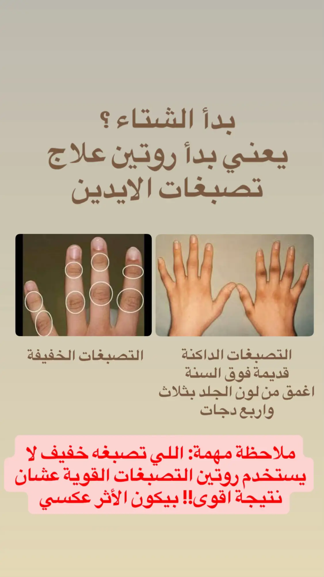 #تصبغات #اسمرار_اليدين #acm #bioderma #eucerin #iherb #الشعب_الصيني_ماله_حل😂😂 