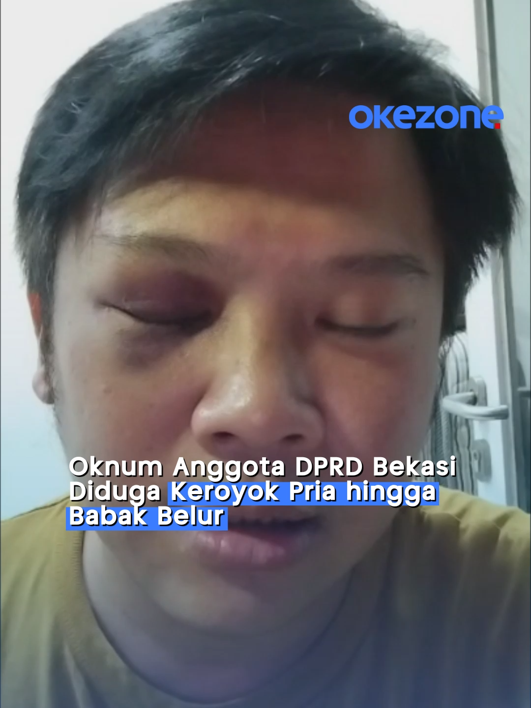 Seorang pria dikeroyok hingga babak belur di sebuah restoran di Cikarang, Bekasi. Aksi itu diduga melibatkan anggota DPRD Kabupaten Bekasi dan rekan-rekannya. Korban mengalami lebam di sekujur tubuh. #okezone #DPRDBekasi #pengeroyokan #oknum