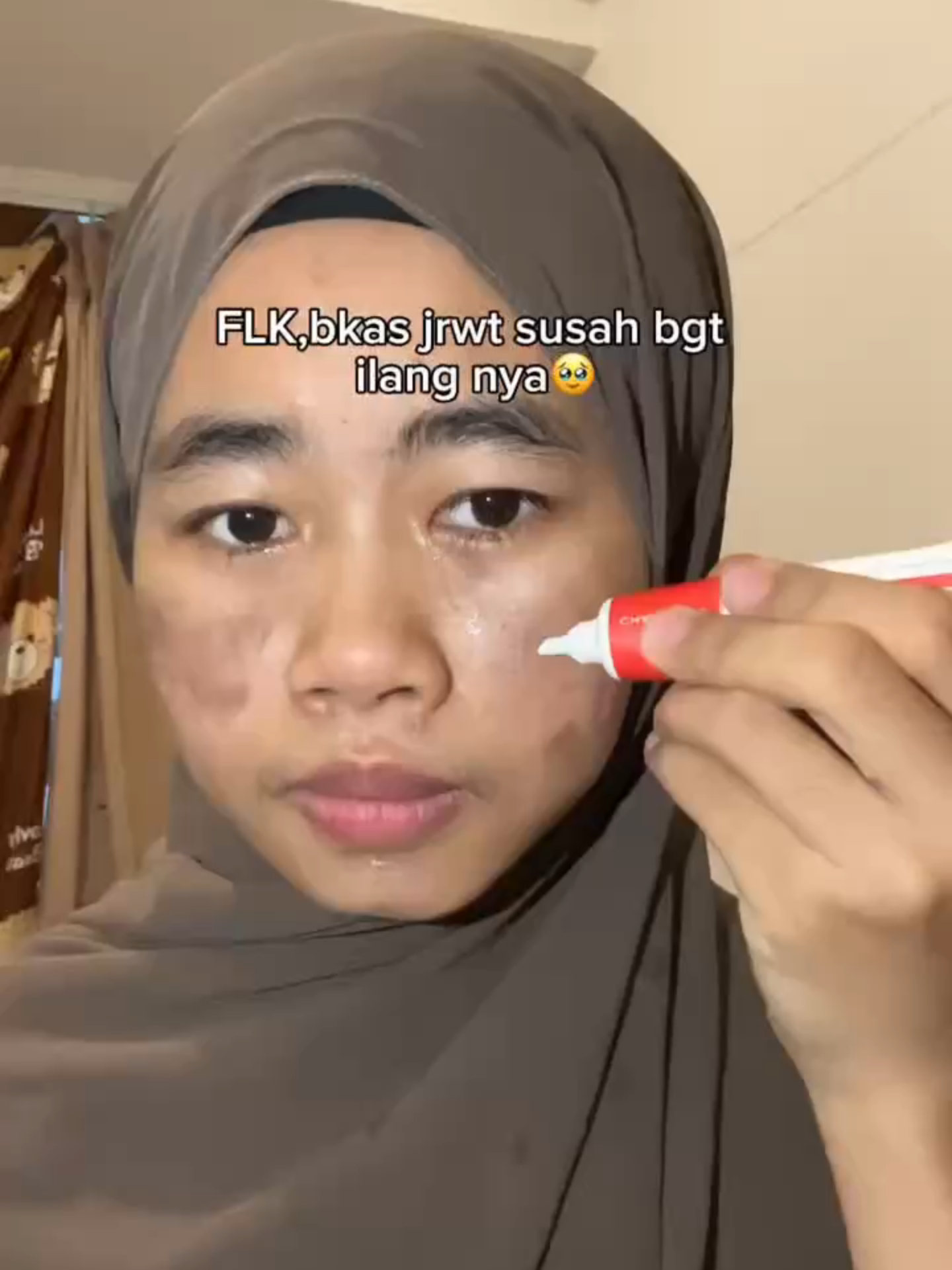 Udah ga bingung lagi sekarang, sama masalah jeriwit dan fleki🤩✨#fyppppppppppppppppppppppp #skincareviral #masukberandafyp #ForYourBeauty #solusijerawat #produkhemat #chalonesecreamwhiteningandfreckleremoval #skincareroutine #skincaretips #PayDaySale #diskonakhirtahun #diskonakhirbulan#cerahglowing #BigSale #4u #H