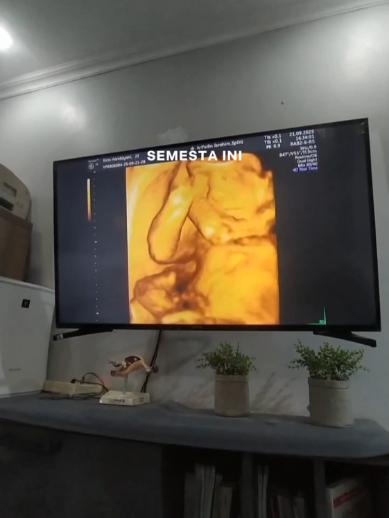 masyaallah kesayanganku🥰sehat sehat ya nak#masyaallahtabarakkallah #bumil #pregnant #masukberandafyp 