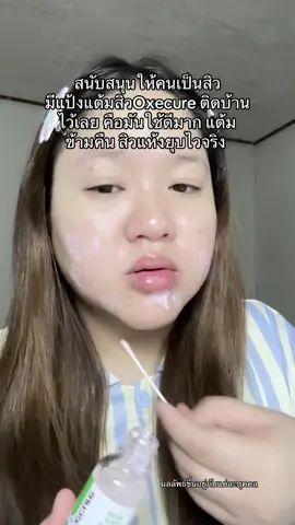 แล้วซื้อใน TikTok คือราคาดีมาก  #แต้มสิว #แป้งน้ําแต้มสิว #oxecure #แป้งโคลนอ็อกซีเคียว #สิวหาย  @นุ่ม‘นะ   𐙚⋆  @นุ่ม‘นะ   𐙚⋆  @นุ่ม‘นะ   𐙚⋆ 