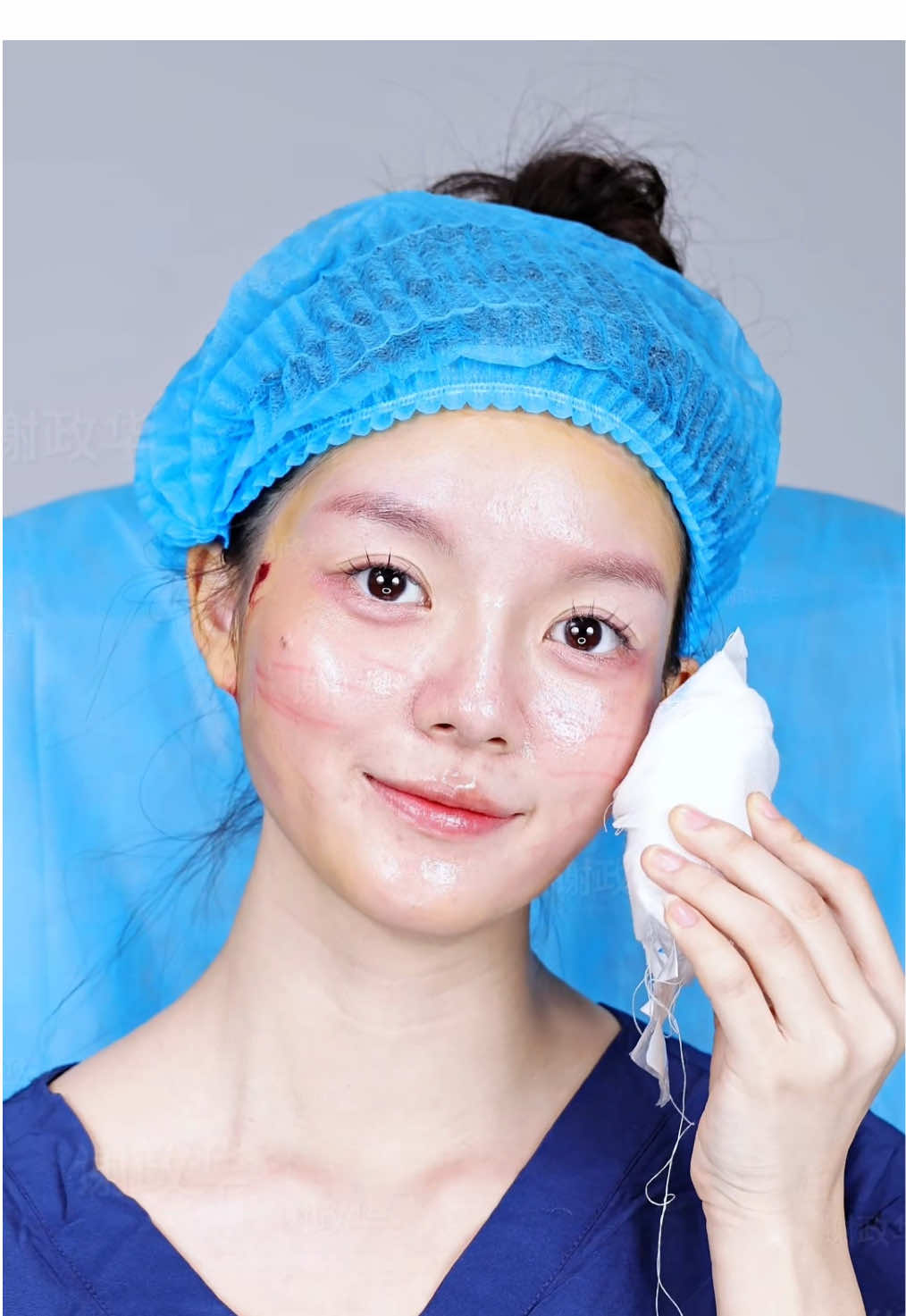 No bone shaving. No drastic change. Just pure lifting — and suddenly a square face becomes softly rounded. This is the 9D Natural Contour Aesthetic: a unique design approach that reshapes the face through deep soft-tissue repositioning, vertical lifting, and subtle refinement. A gentler outline, a softer vibe, and a naturally balanced contour. 💫 #9DLift #NaturalContours #SoftLift #FacialRejuvenation #ContourRefinement     