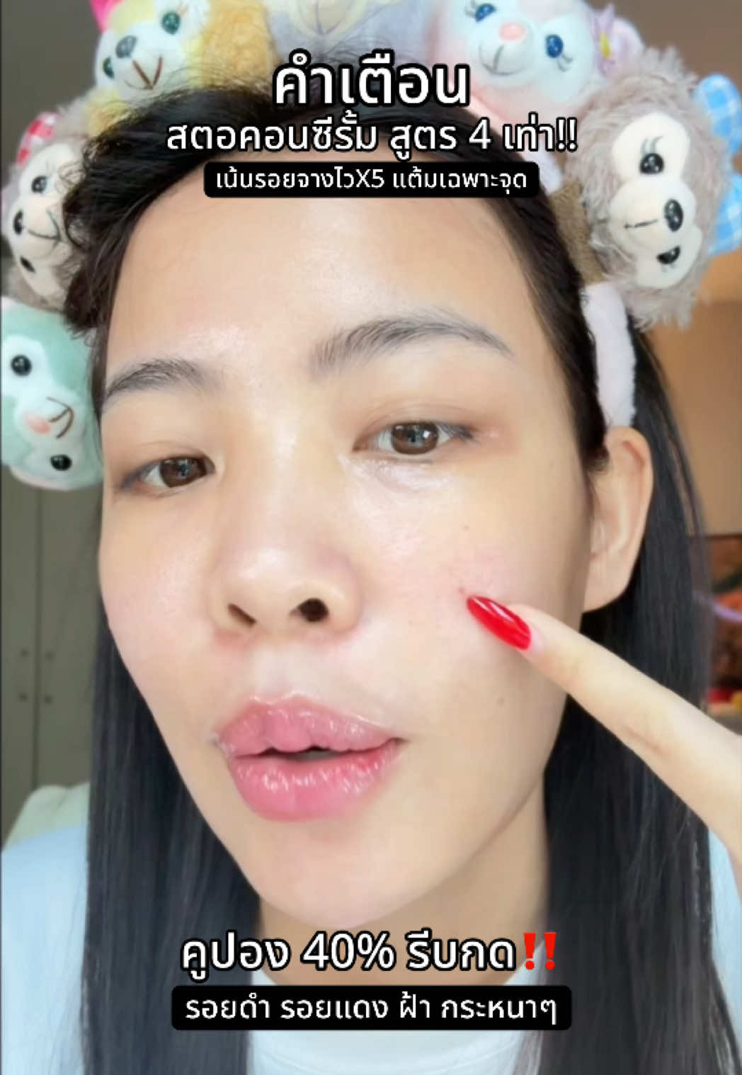 #yerpallthailand #yerpall #รอยดํา #รอยแดง #ฝ้ากระ 