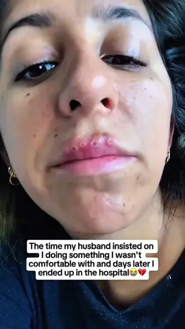 💔 I never imagined I’d watch the woman I love fight for her life while I stood powerless beside her. Day by day, I watched her strength fade — not all at once, but slowly… painfully… heartbeat after heartbeat. 🛏️ I spent countless nights in that hospital chair, holding her hand, praying she’d squeeze back. 💭 The weight of guilt, fear, and unanswered questions felt unbearable. 🔊 Machines humming… alarms going off… doctors searching for solutions they couldn’t find. But nothing compared to the moment I had to tell our newborns that their mom might not open her eyes again. 😔💔 And still — despite everything — I refuse to let go of hope. I’m still believing for a miracle. 🙏💙 Please keep Marcela in your prayers. #faithandhope  #familyfirst  #loveneverfails♥️  #miracleinprogress 