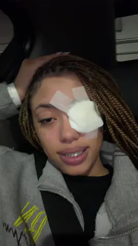 Corneal abrasions are top 10 worse feelings ever 😭 #contactlenses #cornealabrasion #fypシ 