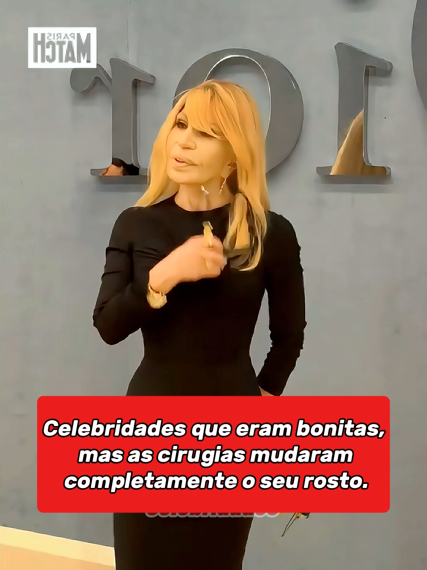 Quando a busca pela perfeição muda mais do que a aparência… muda a história.  #Transformações #AntesEDepois #CuriosidadesDeFamosos #CulturaPop #Celebridades #EstéticaY2K #Famosos #ViralNews #atores #hollywood