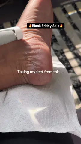 My feet were too dry 😭 #feetcare #electricfile #dryfeet #pedicure #tiktokshopblackfriday 