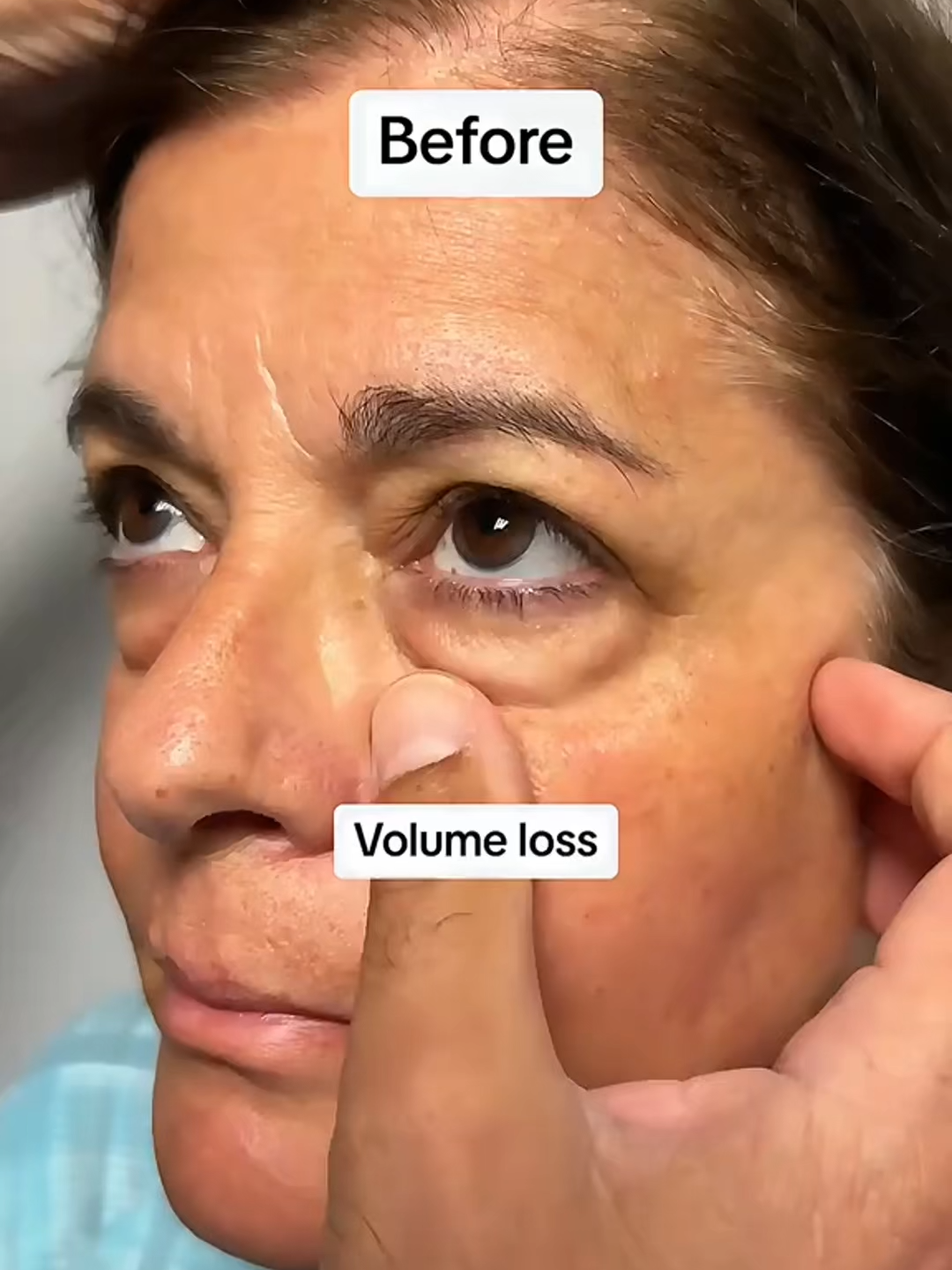 Hoy podés aprovechar un 50% de DESCUENTO REAL, pero solo hasta que se agoten. 🔥 Esta es tu oportunidad de llevarte lo mejor al mitad de precio, sin vueltas y sin trucos. El tiempo corre y el stock baja rápido… ⏳