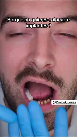 #fyp #implantologo #implantologos #viraltiktok #paratiiiiiiiiiiiiiiiiiiiiiiiiiiiiiii 