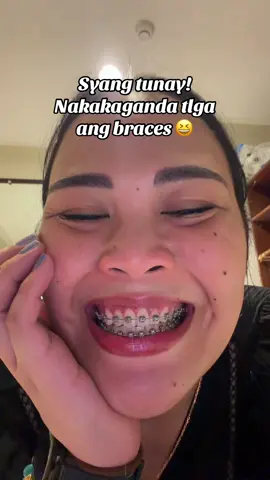 #braces #fyp 