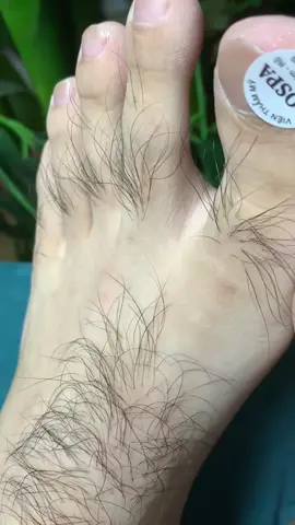 Nuôi ạ #chamsocdamun#chamsocdaseo#chamsocdanam#tanbinh#Lqspa&academy#