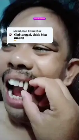 Hasil 7 hari! Beli sekarang, ada diskon. Jangan nunggu, gigi udah sembuh pas kamu masih mikir YP792Z