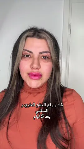 #danmark🇩🇰 #دنمارك🇩🇰 #عفرين #بيوتي 