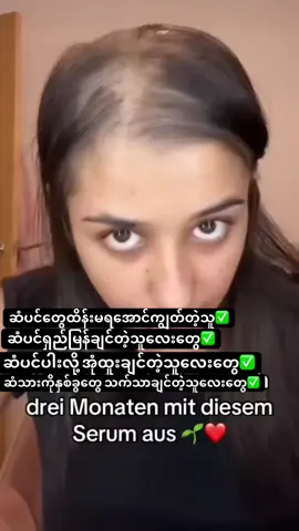 ဆံပင်ပေါက်ဆေး#princess99👸cosmetics #Mandalay #ဆံပင်ပြသနာရှိသူတိုင်းကြည့်ပေးပါ #Hairoil #fyppppppppppppppppppppppp 