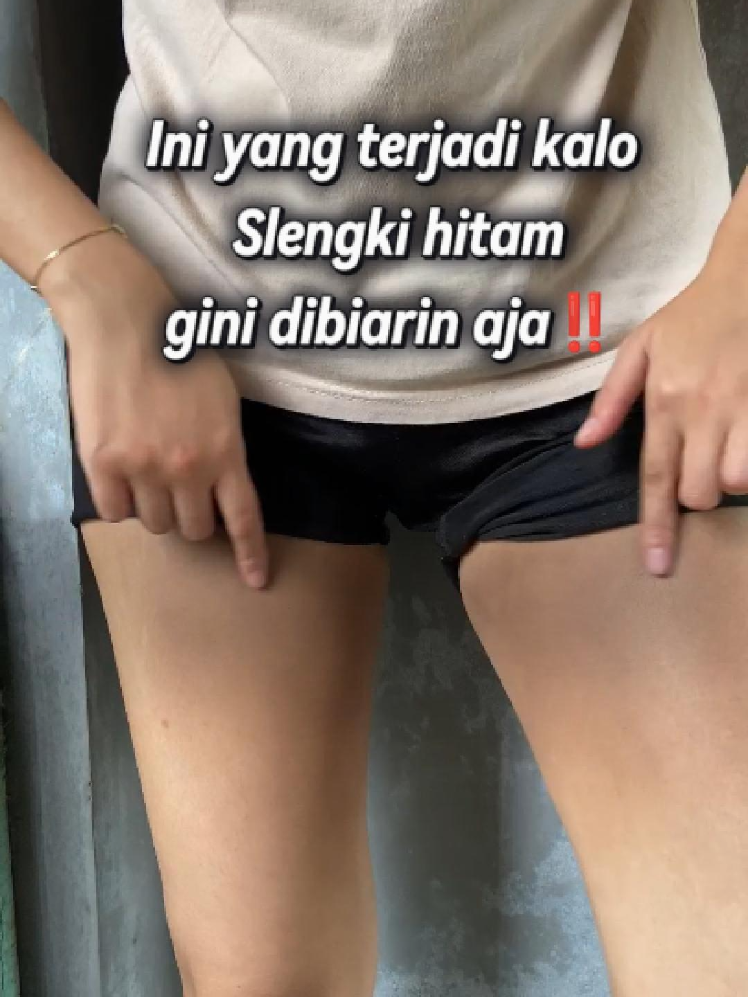 INI YANG BAKAL TERJADI KALO SLENGKI HITAM TAPI DIBIARIN AJA!😱😱😱#nei #neipeelingspray #peelingspray #perontokdaki #daki #kulitkusam #kulitbelang #kulitputih #kulitcerah #slengki #slengkihitam #slengkiglowing #slengkicerah #bodycare #fyp #fypp #fyppppppppppppppppppppppp #foryou #fypage