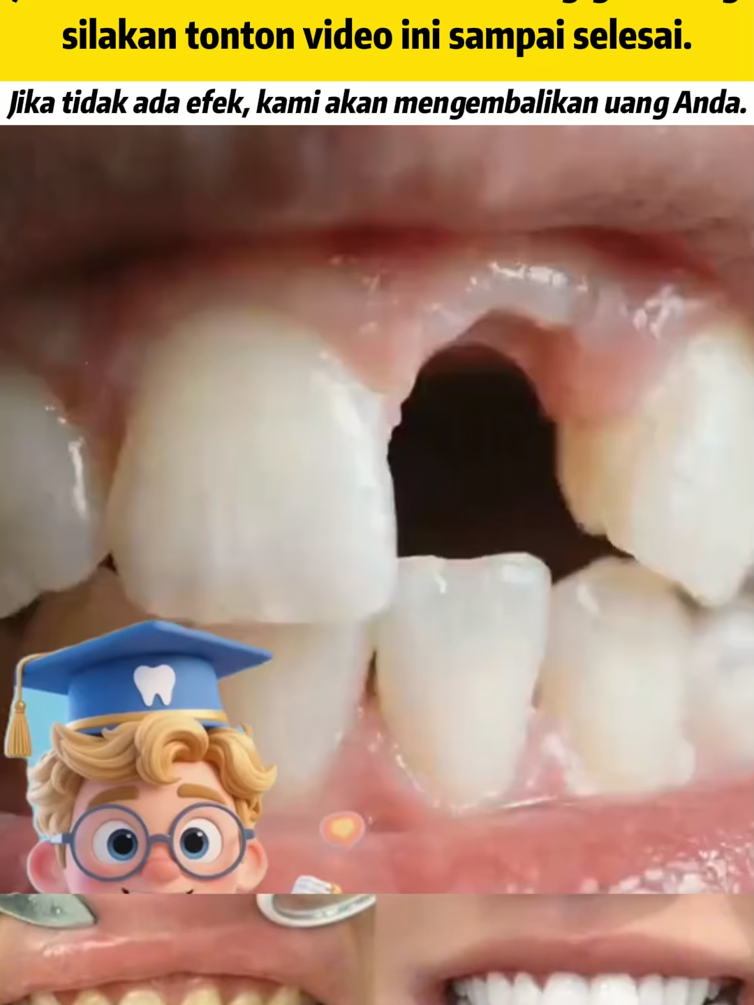 Gigi putih cemerlang hanya dalam 7 hari? Coba SP7!#dental #pastagigi #SP7 #Kesehatangigi #gigi #Karanggigi