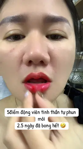 Đã bong . Mọi người tiếp tục bôi dưỡng nha . Lúc này da non yếu lắm cần dưỡng để hỗ trợ nhanh phục hồi và lên màu . 🍀#môi_sau_bong #phunxamlongkhanh #tiktoklive 