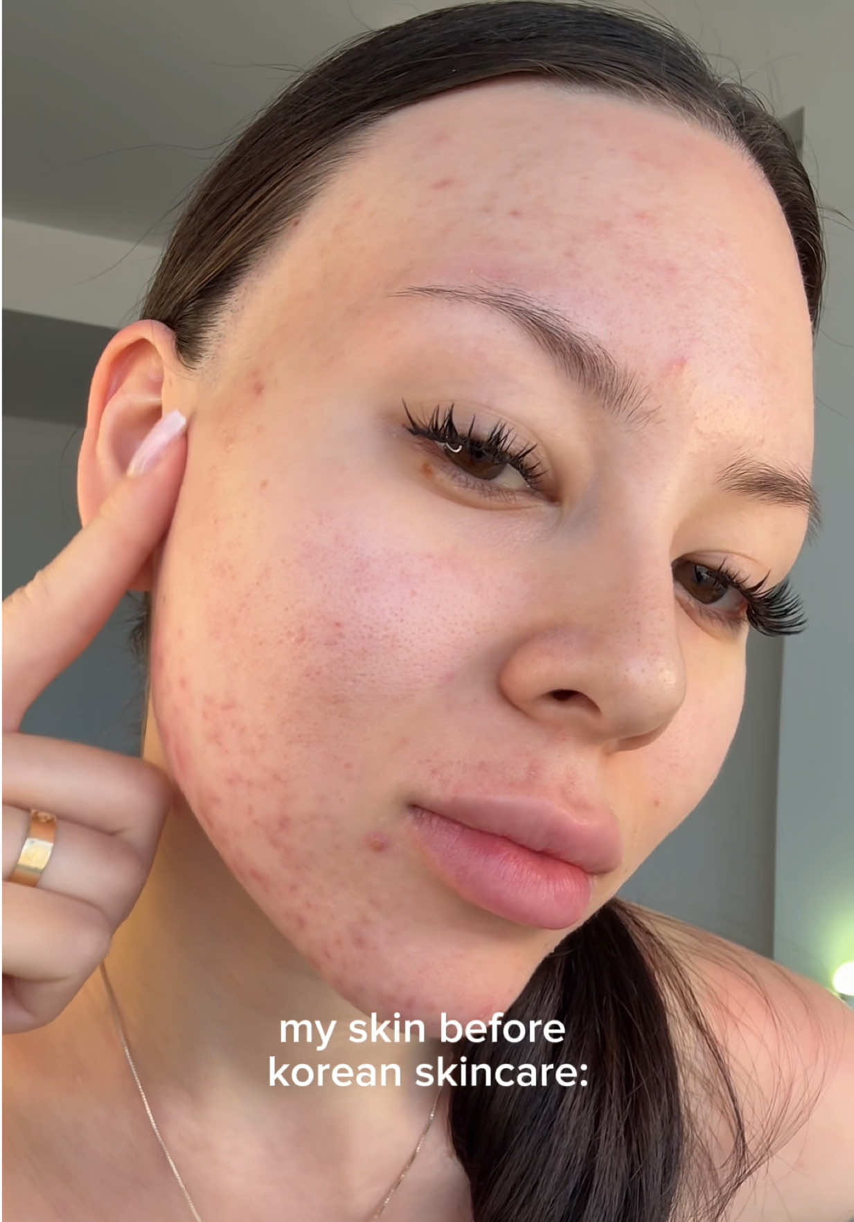 simple steps, healthier skin ✨ #skincare #kbeauty #skinbarrier #glowingskin #SelfCare