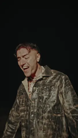 tu sei come un livido ❤️‍🩹 #lovesongs #popmusic 