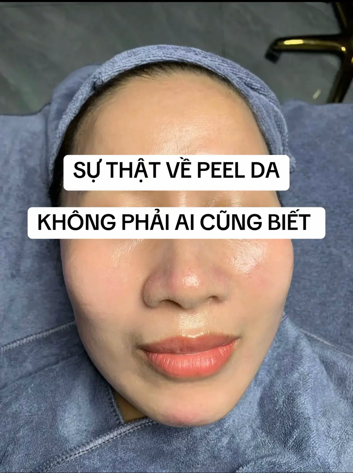 #mun #munan #spabacninh #thuykieubeauty8 #duocmypham 