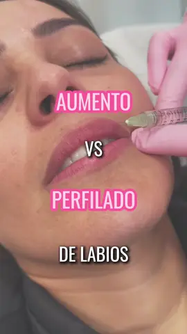 Aumento de labios VS Perfilado 💉👄 Para más información déjanos un comentario 💬 #labios #tratamiento #acidohialuronico 