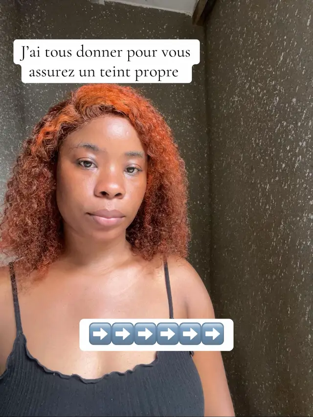 Tu veux une peau plus belle, plus uniforme et lumineuse sans te ruiner ? Ce week-end, je te propose un kit complet pour transformer ta peau… à prix mini 😍 Le Kit Spécial Glow (10.000F) contient : ✨ Savon teint métisse → unifie, illumine ✨ Mini gel douche Sun Bright → exfolie, clarifie la peau ✨ Savon visage nettoyant → enlève impuretés + excès de sébum 💛 Idéal pour : • Teint terne • Petites taches • Peau fatiguée • Besoin d’un glow rapide ✨ 🔥 Seulement 12 kits disponibles ! Quand les 12 sont partis, l’offre disparaît.