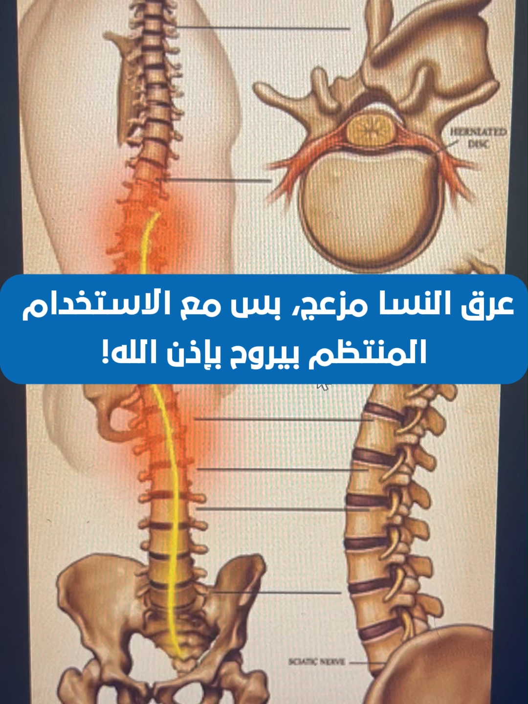 اطلبها الآن – التوصيل مجاني وسريع لين باب بيتك 🚚✨ #لفافة_القدم_الأخمصية #عرق_النسا_sciatica #الشعب_الصيني_ماله_حل😂😂 #المفاصل_الصناعية #الشعب_الصيني_ماله_حل #ألام_الرأس_و_الصداع #خشونة_الفقرات #المفاصل_الروماتيزم_الظهر_العظام #المفاصل_الروماتويدي #الرياض_الان #وجع_مفاصل #foryoupage #السعودية🇸🇦 #ألام_الرقبة #saudiarabia #ألام_مفاصل #الدمام #جدة_الان #مكة #عرق_النسا